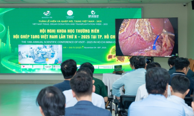 Vinmec trình diễn kỹ thuật ghép gan sống phức tạp tại Hội nghị Ghép tạng Việt Nam 2025