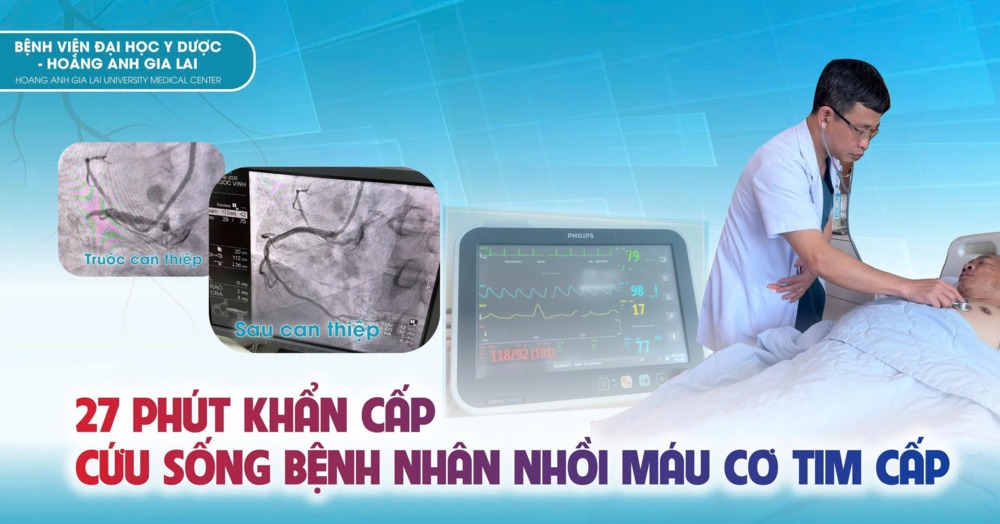 Bệnh viện ĐHYD-HAGL: 27 phút khẩn cấp cứu sống bệnh nhân nhồi máu cơ tim